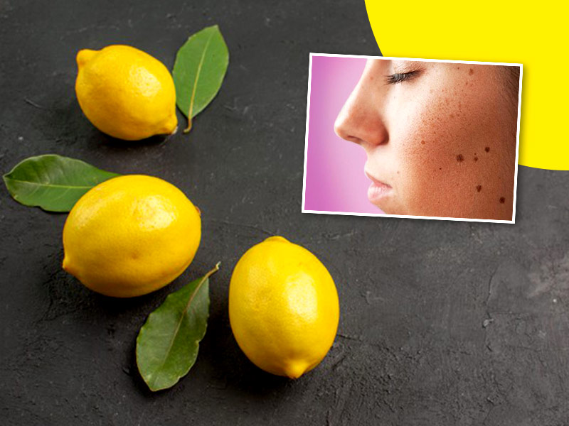 wellhealthorganic.com/easily-remove-dark-spots-lemon-juice